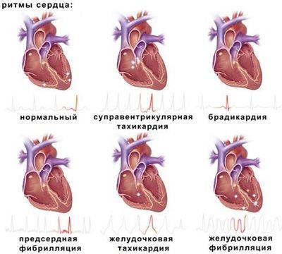 ритмы сердца ритмы сердца