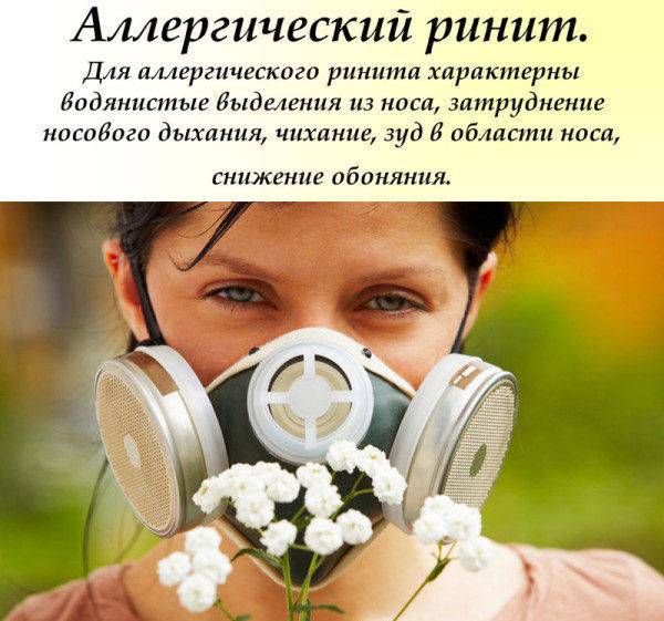 Ринит