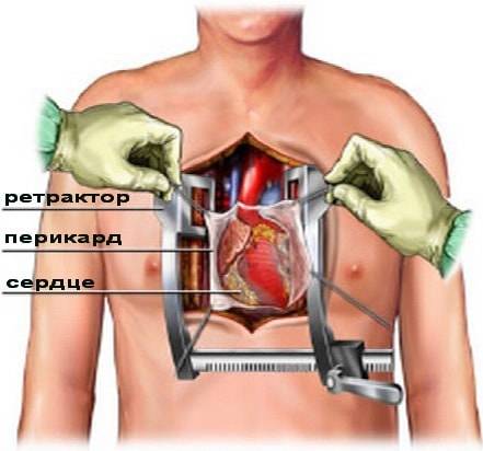 показания_противопоказания