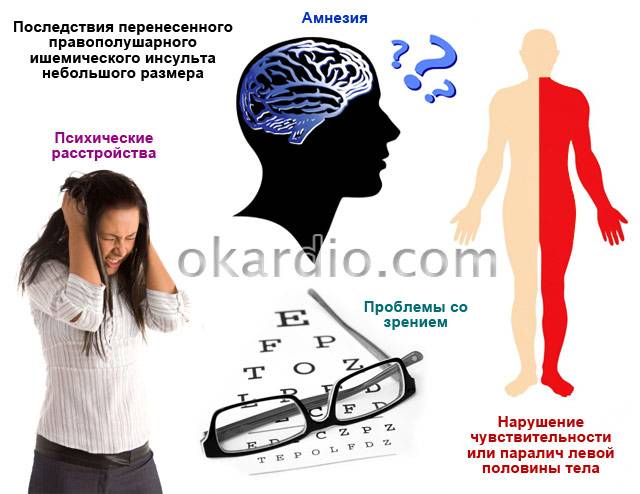 последствия правополушарного ишемического инсульта