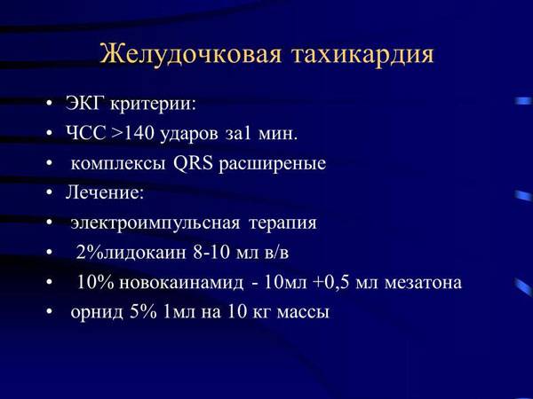 ЭКГ критерии желудочковой тахикардии