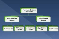 Классификация форм инфаркта миокарда Классификация форм инфаркта миокарда