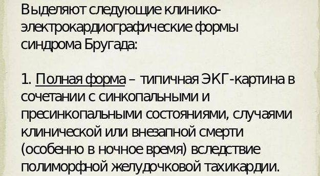 Синдром Бругада (СБ)