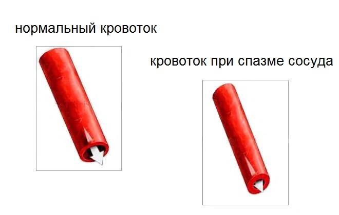 Снимаем спазм сосудов головного мозга