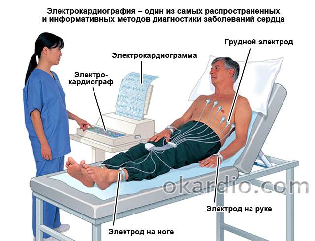 электрокардиография