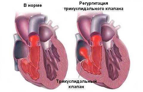 Этиология болезни