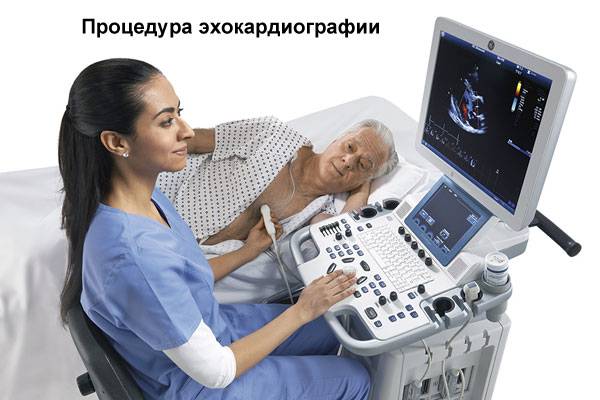 эхокардиография