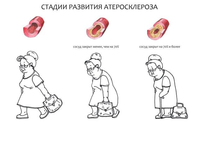 Суть болезни