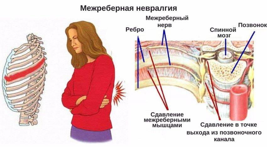 причины острой боли за грудиной