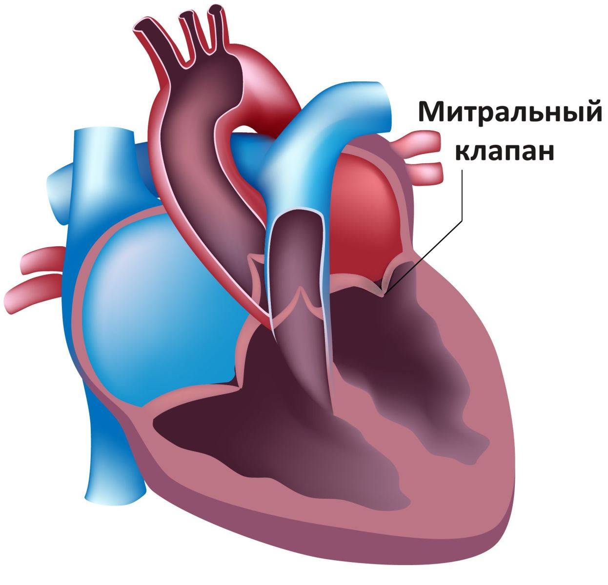 Пролапс митрального клапана что это?
