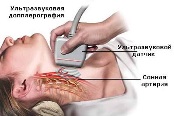 Брахиоцефальные сосуды изучает сонолог