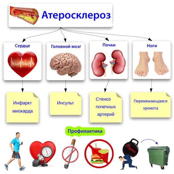 Атеросклероз