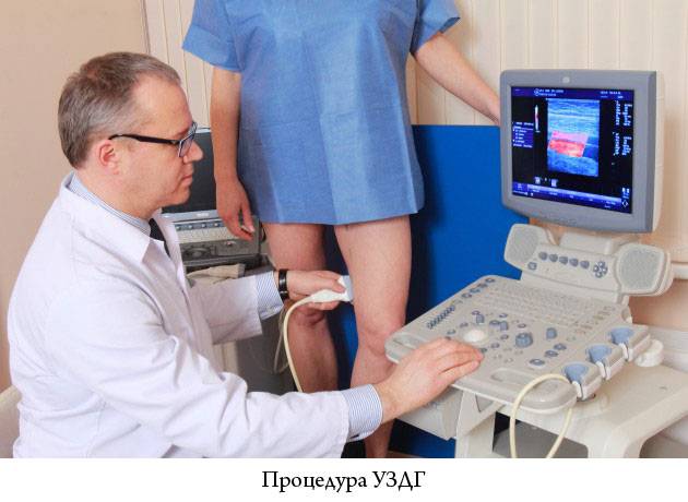 процедура допплерографии