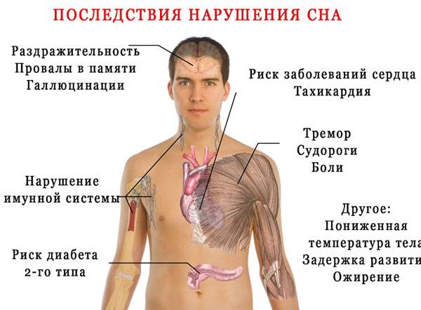 Возможные последствия нарушения сна