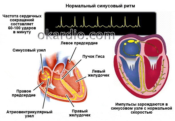 нормальный синусовый ритм
