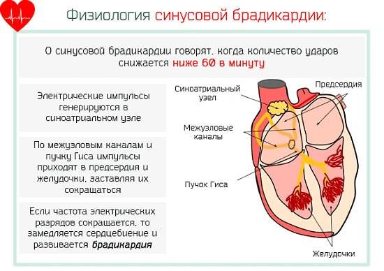 Что такое брадикардия сердца