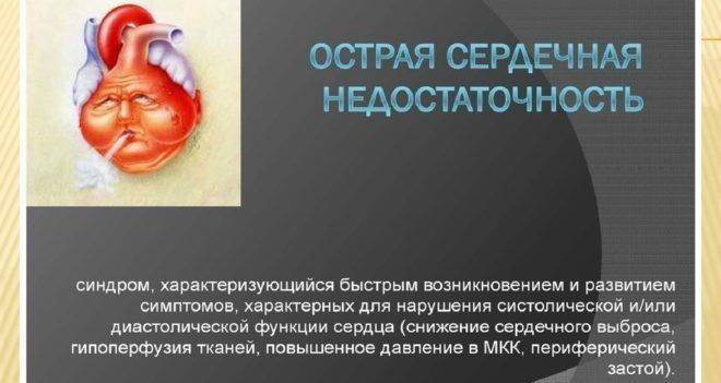 Острая сердечная недостаточность