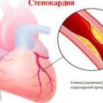 Признаки ишемии сердца у женщин