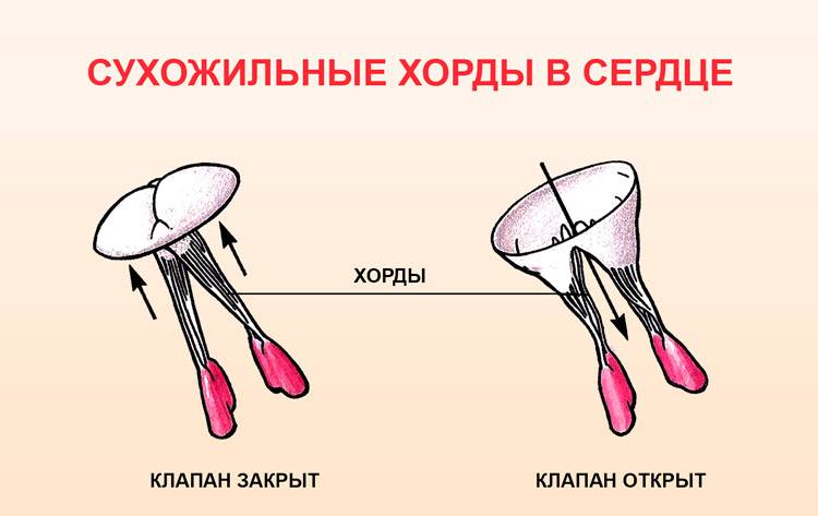 Сухожильные хорды в сердце
