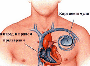 ритме работы сердца