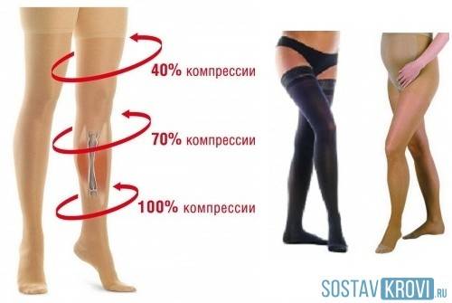 Принцип воздействия