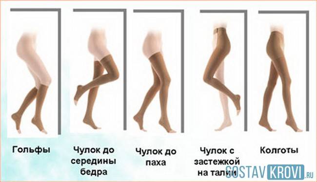 Виды