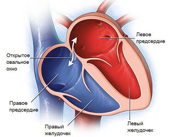 Открытое овальное окно