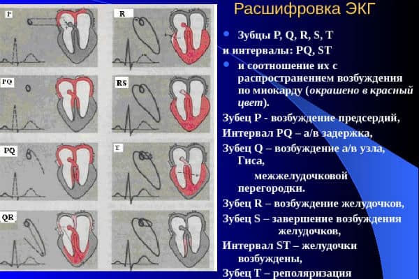 Кардиограмма сердца расшифровка