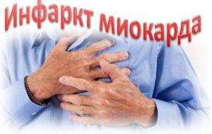 Инфаркт миокарда