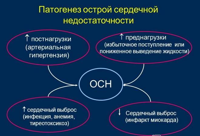 Патогенез острой сердечной недостаточности