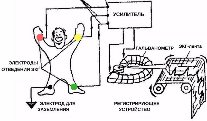 снятие экг