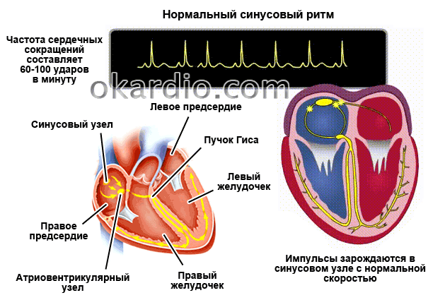 нормальный синусовый ритм