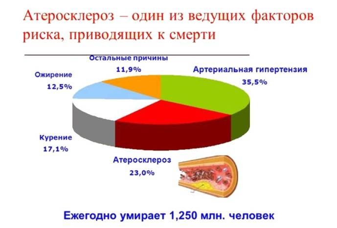 Факторы риска