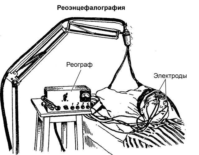 устройство аппарата для РЭГ