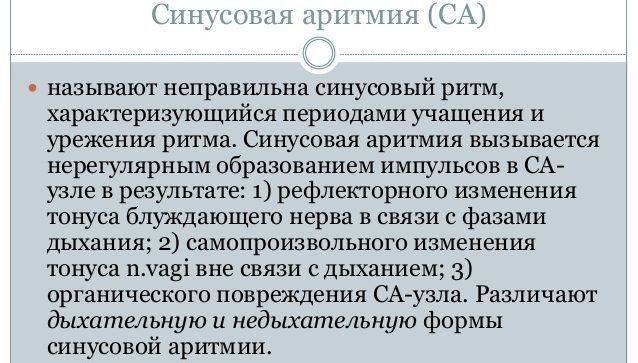 Синусовая аритмия
