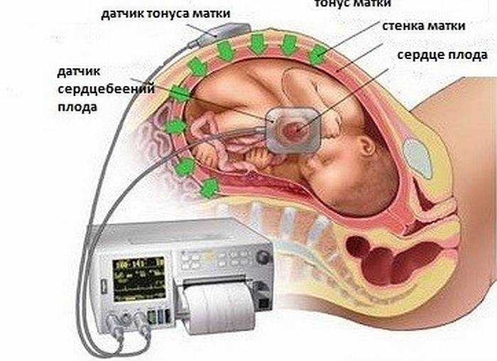 Сердцебиение плода на каком сроке