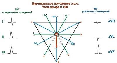 электрическая ось сердца электрическая ось сердца