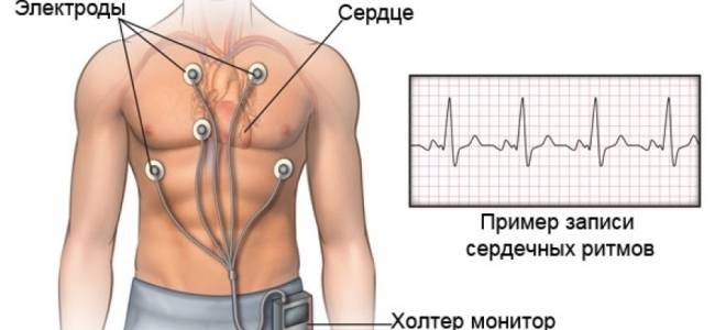 система холтеровского мониторирования