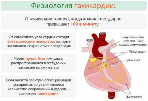 Тахикардия Физиология тахикардии