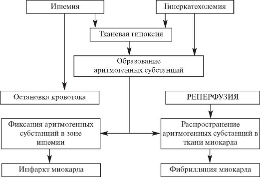 Развитие фибрилляции желудочков и инфаркта миокарда