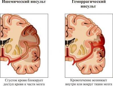 Иллюстрация 1 Иллюстрация 1