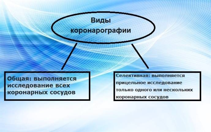 Виды коронарографии