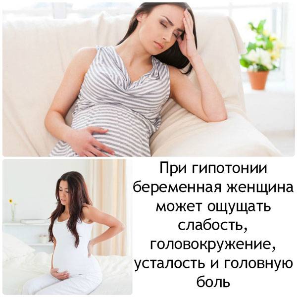 Симптомы гипотонии при беременности