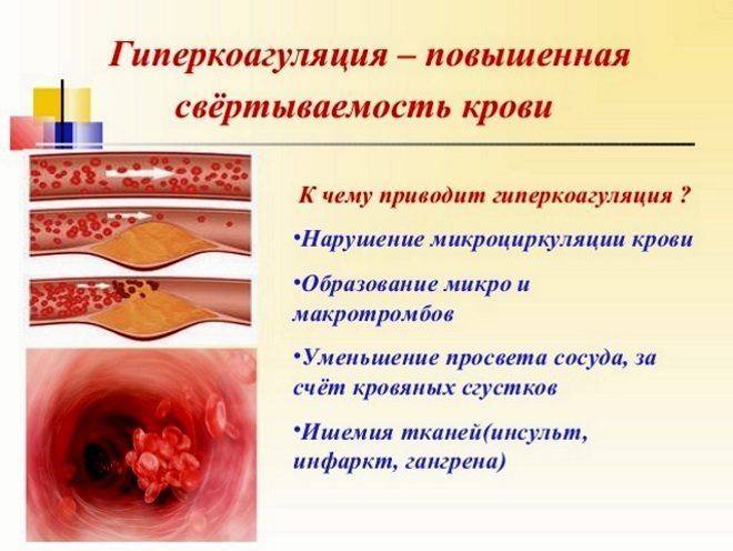 Повышенная свертываемость крови Повышенная свертываемость крови ведет к закупорке сосудов