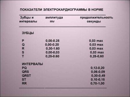 Расшифровка экг показатели нормы таблица