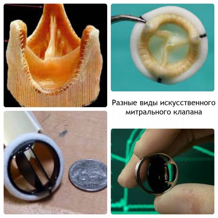 Разные клапана