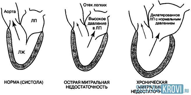 Классификация