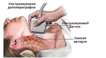 Метод ультразвуковой допплерографии