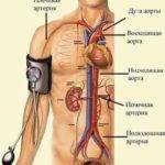 Что представляет собой АД?