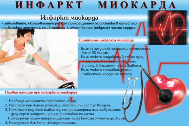 Острый инфаркт у женщин